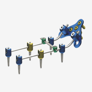 OCCIPLITAL SCREW