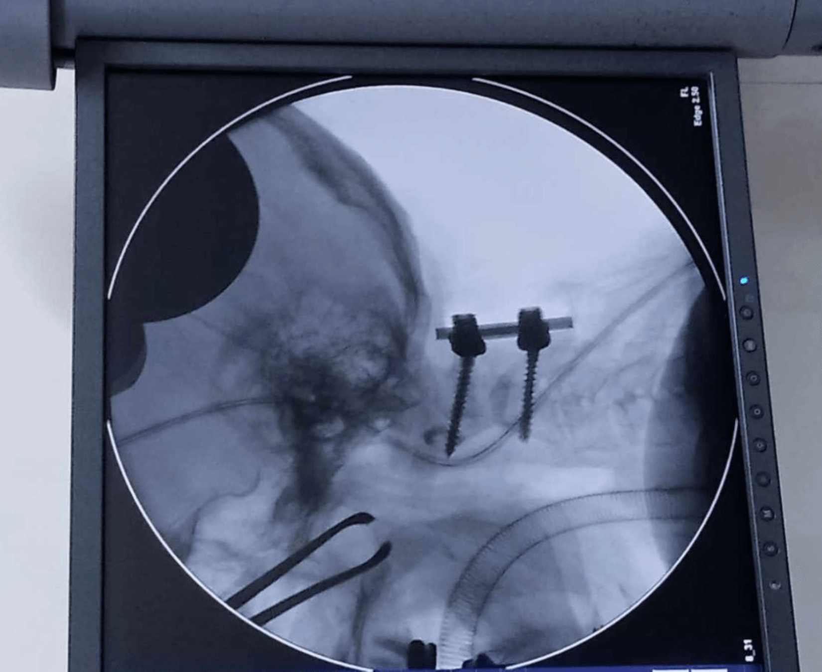 মহানন্দা Lateral Mass - Image 6
